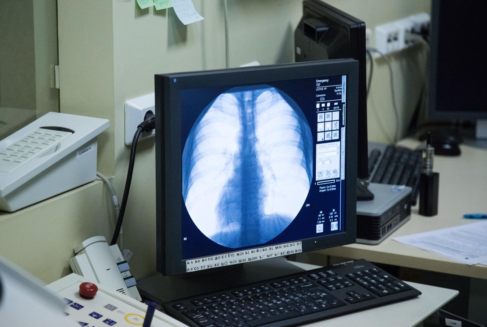 Первый день зимнего осмотра в ММЦ «СОГАЗ»