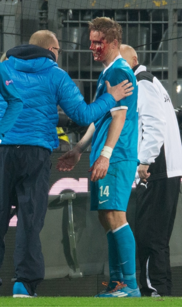 Лига Чемпионов УЕФА: матч «Боруссия» — «Зенит»