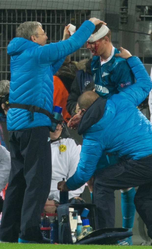 Лига Чемпионов УЕФА: матч «Боруссия» — «Зенит»