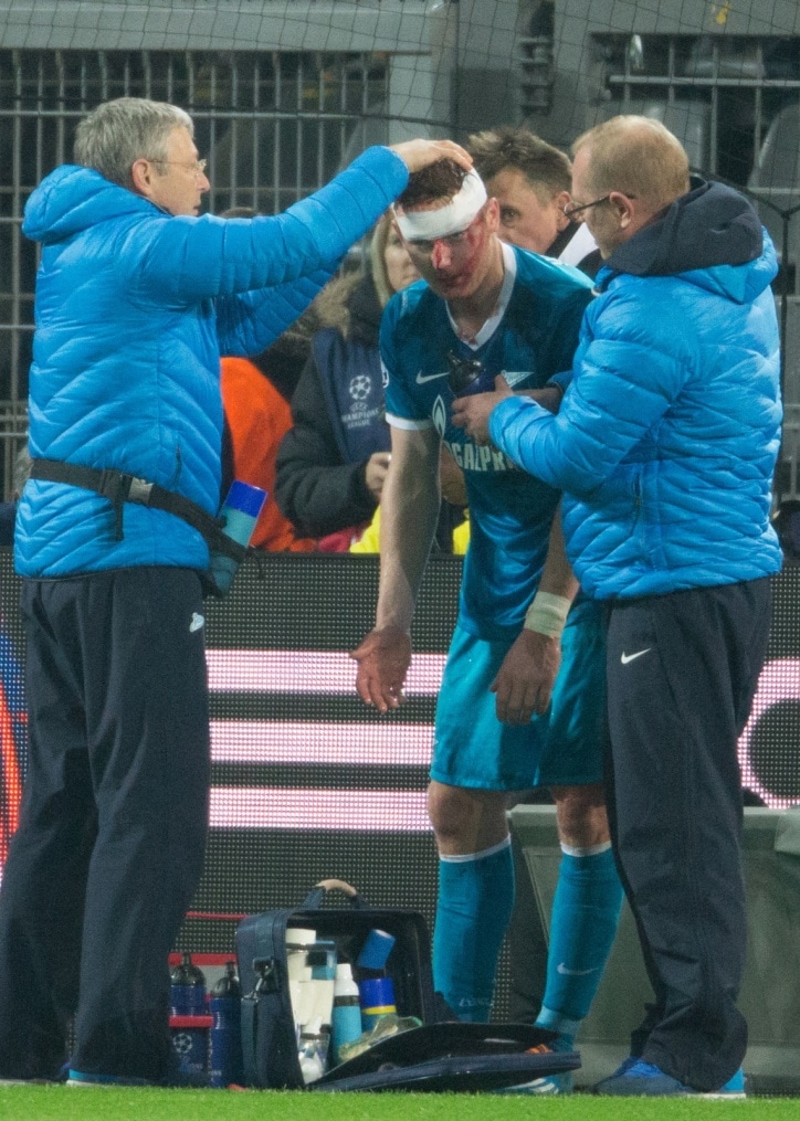 Лига Чемпионов УЕФА: матч «Боруссия» — «Зенит»