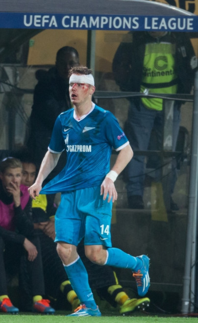 Лига Чемпионов УЕФА: матч «Боруссия» — «Зенит»