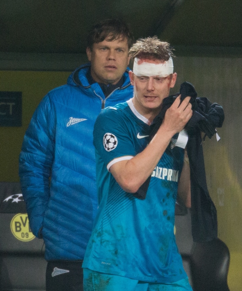 Лига Чемпионов УЕФА: матч «Боруссия» — «Зенит»